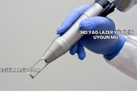 ND:YAG Lazer Yüz İçin Uygun mu?