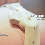 NST Testi Ne Zaman Yapılır?