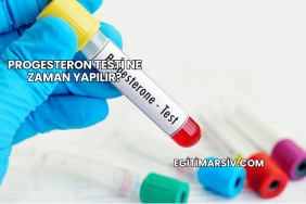 Progesteron Testi Ne Zaman Yapılır?