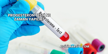 Progesteron Testi Ne Zaman Yapılır?