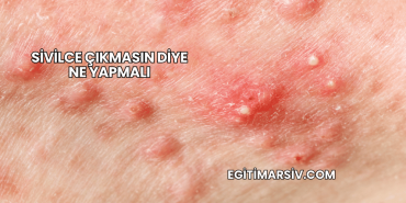 Sivilce Çıkmasın Diye Ne Yapmalı