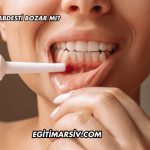 Diş Kanaması Abdesti Bozar mı?