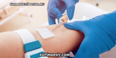 Kan Abdesti Bozar mı?