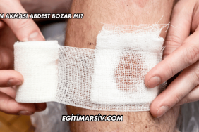 Kan Akması Abdest Bozar mı?