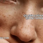 Çillerin Çoğalması İçin Ne Yapmalı?