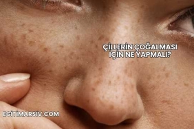 Çillerin Çoğalması İçin Ne Yapmalı?