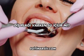 Diş Plağı Varken Su İçilir mi?
