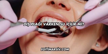 Diş Plağı Varken Su İçilir mi?