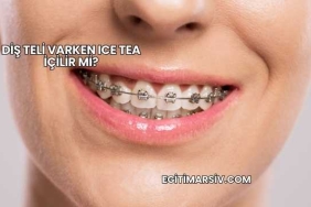 Diş Teli Varken Ice Tea İçilir mi?