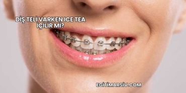 Diş Teli Varken Ice Tea İçilir mi?