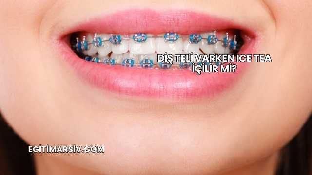 Diş Teli Varken Ice Tea İçilir mi?