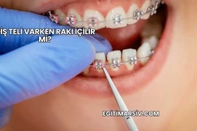 Diş Teli Varken Rakı İçilir mi?