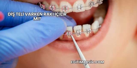 Diş Teli Varken Rakı İçilir mi?