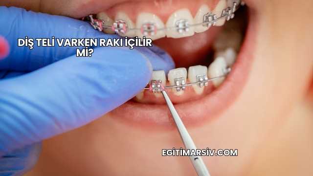 Diş Teli Varken Rakı İçilir mi?