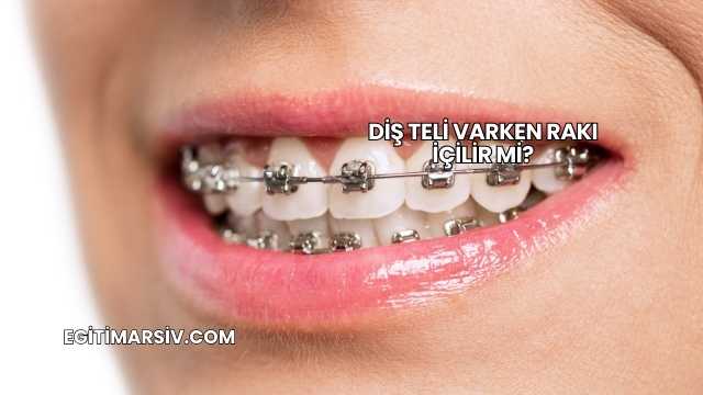 Diş Teli Varken Rakı İçilir mi?