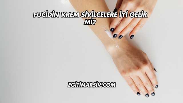 Fucidin Krem Sivilcelere İyi Gelir mi?