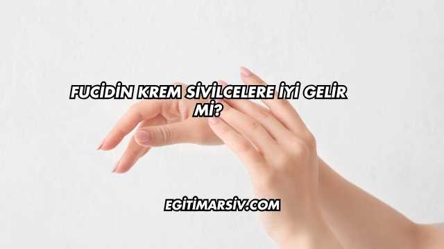 Fucidin Krem Sivilcelere İyi Gelir mi?