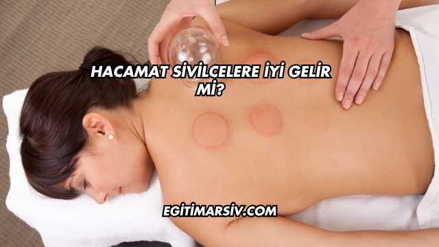 Hacamat Sivilcelere İyi Gelir mi?