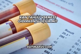 Kan Tahlili Vermeye Giderken Su İçilir mi?