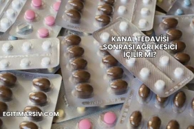 Kanal Tedavisi Sonrası Ağrı Kesici İçilir mi?