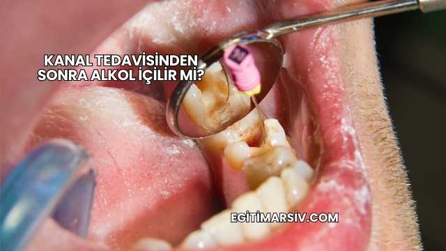 Kanal Tedavisinden Sonra Alkol İçilir mi?