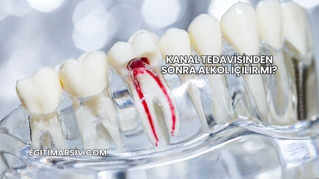 Kanal Tedavisinden Sonra Alkol İçilir mi?