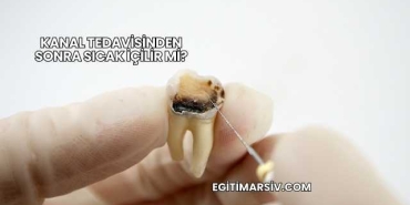 Kanal Tedavisinden Sonra Sıcak İçilir mi?