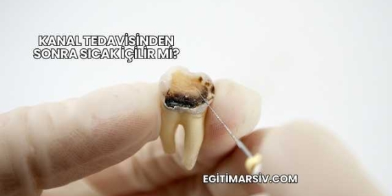 Kanal Tedavisinden Sonra Sıcak İçilir mi?