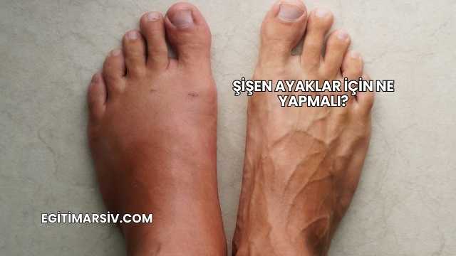 Şişen Ayaklar İçin Ne Yapmalı?