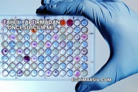 Tahlil Yaptırmadan Önce Su İçilir mi?