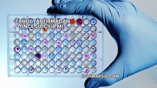 Tahlil Yaptırmadan Önce Su İçilir mi?