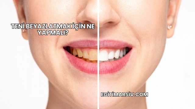 Teni Beyazlatmak İçin Ne Yapmalı?