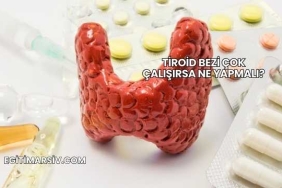 Tiroid Bezi Çok Çalışırsa Ne Yapmalı?