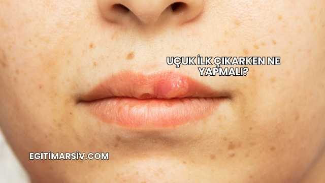 Uçuk İlk Çıkarken Ne Yapmalı?