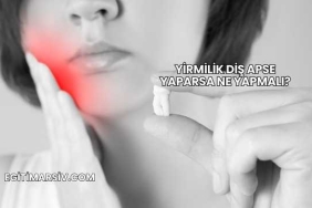 Yirmilik Diş Apse Yaparsa Ne Yapmalı?