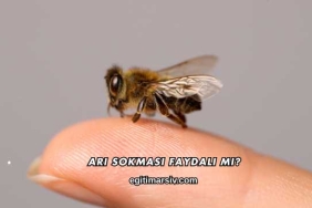 Arı Sokması Faydalı mı?