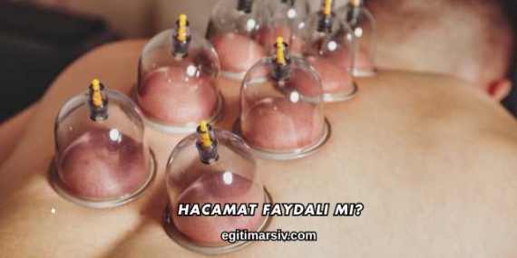 Hacamat Faydalı mı?