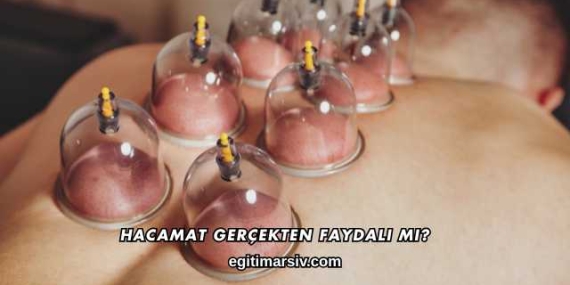 Hacamat Gerçekten Faydalı mı?
