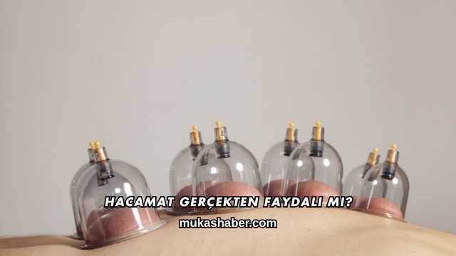Hacamat Gerçekten Faydalı mı?