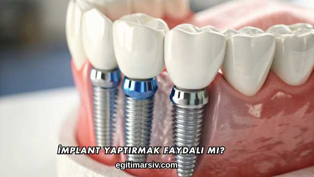 İmplant Yaptırmak Faydalı mı?