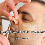 Burun Kılları Lazerle Alınır mı?