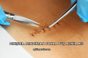 Dikişler Alındıktan Sonra Duş Alınır mı?