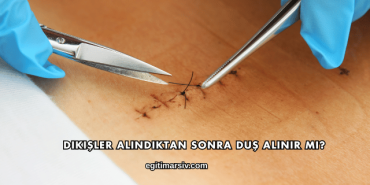 Dikişler Alındıktan Sonra Duş Alınır mı?