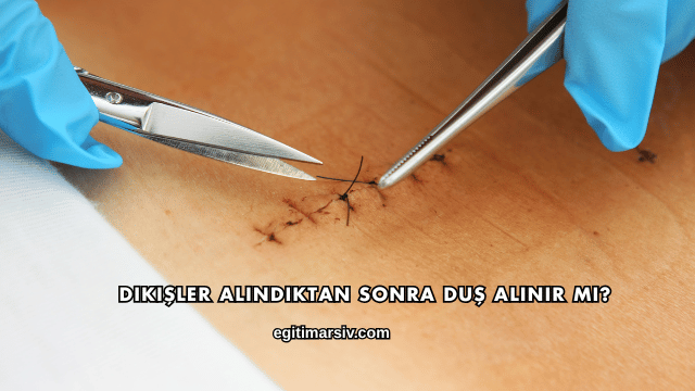 Dikişler Alındıktan Sonra Duş Alınır mı?