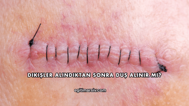 Dikişler Alındıktan Sonra Duş Alınır mı?