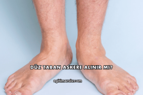 Düz Taban Askere Alınır mı?