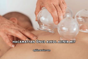 Hacamattan Önce Alkol Alınır mı?
