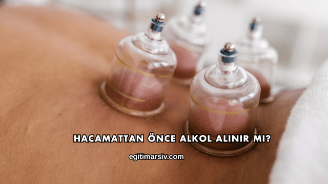Hacamattan Önce Alkol Alınır mı?