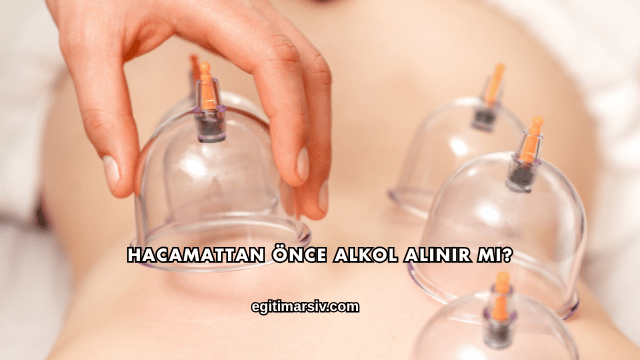 Hacamattan Önce Alkol Alınır mı?