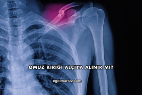 Omuz Kırığı Alçıya Alınır mı?